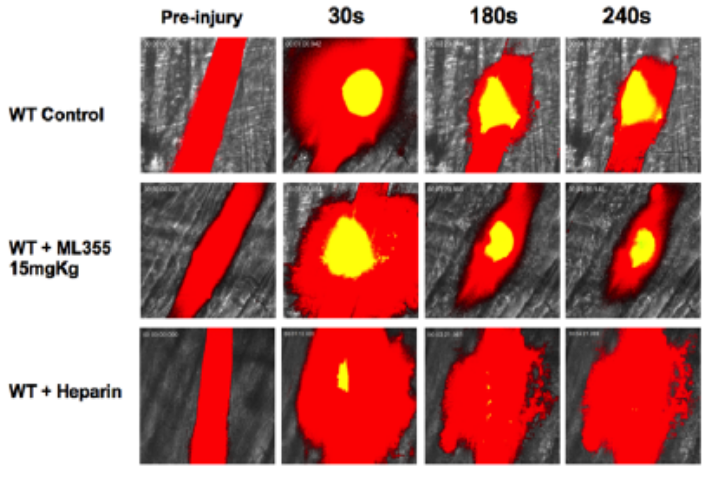 Time-series microscopy images comparing thrombus formation in WT control mice, mice treated with the 12-LOX inhibitor ML355, and mice treated with heparin before injury and at 30, 180, and 240 seconds.